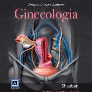 Diagnostico Por Imagem Ginecologia