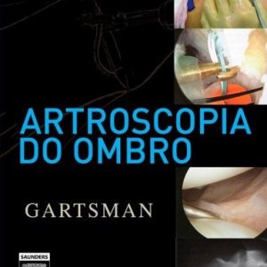 Artroscopia Do Ombro