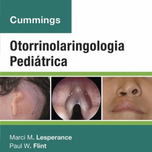 Cummings Otorrinolaringologia Pediatrica