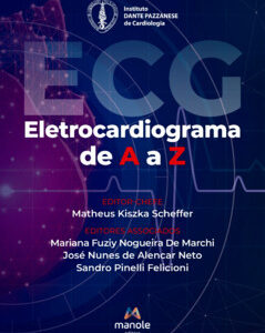 Eletrocardiograma de A a Z