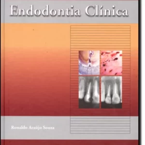 ENDODONTIA CLINICA