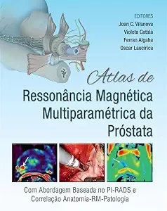 Atlas De Ressonancia Magnetica Multiparametrica