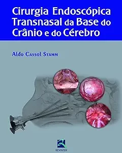 Cirurgia Endoscopica Transnasal Da Base Do Cranio