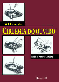 Atlas de Cirurgia do Ouvido